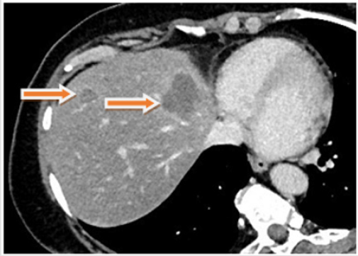 biomedres-openaccess-journal-bjstr