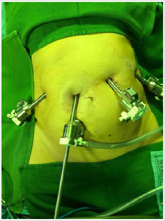 biomedres-openaccess-journal-bjstr