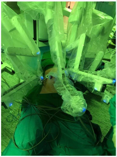 biomedres-openaccess-journal-bjstr