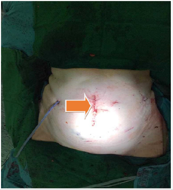 biomedres-openaccess-journal-bjstr