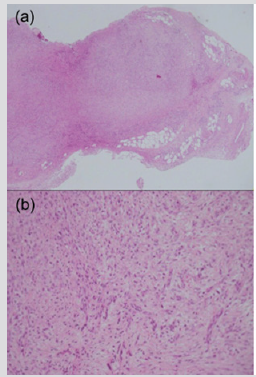 biomedres-openaccess-journal-bjstr