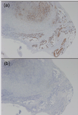 biomedres-openaccess-journal-bjstr