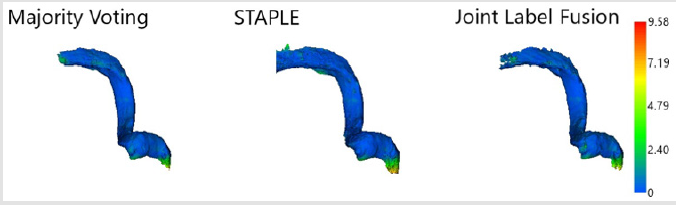 biomedres-openaccess-journal-bjstr