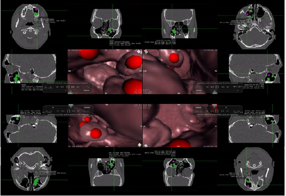 biomedres-openaccess-journal-bjstr