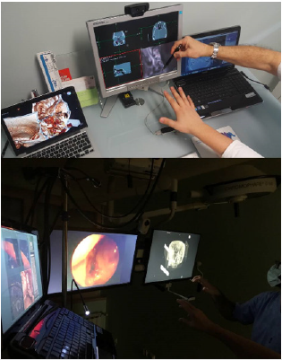 biomedres-openaccess-journal-bjstr
