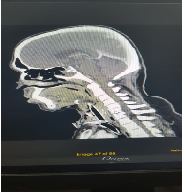 biomedres-openaccess-journal-bjstr