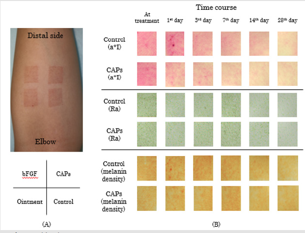biomedres-openaccess-journal-bjstr