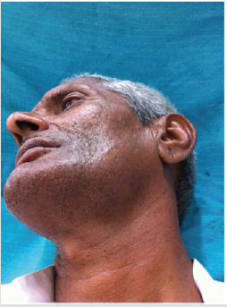 biomedres-openaccess-journal-bjstr