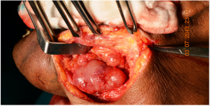 biomedres-openaccess-journal-bjstr