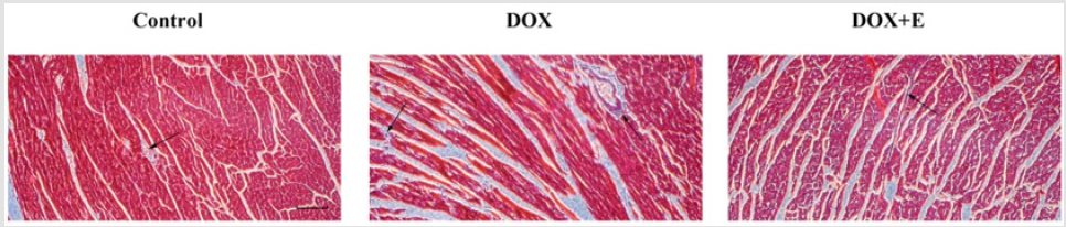 biomedres-openaccess-journal-bjstr