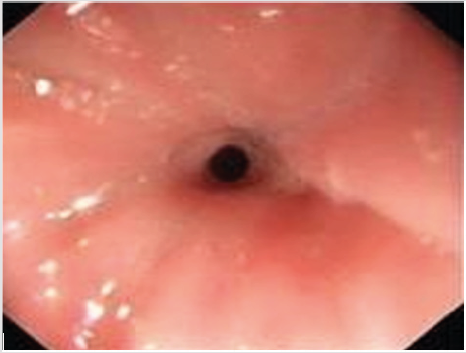 biomedres-openaccess-journal-bjstr