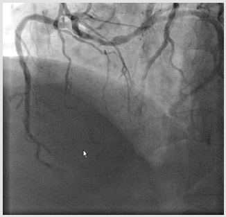 biomedres-openaccess-journal-bjstr