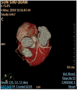 biomedres-openaccess-journal-bjstr