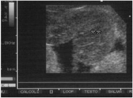 biomedres-openaccess-journal-bjstr