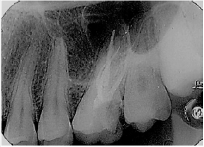 biomedres-openaccess-journal-bjstr