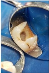 biomedres-openaccess-journal-bjstr