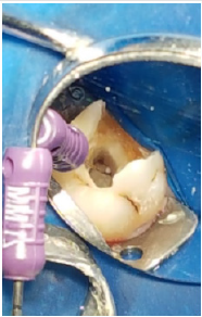 biomedres-openaccess-journal-bjstr