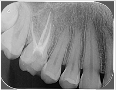biomedres-openaccess-journal-bjstr
