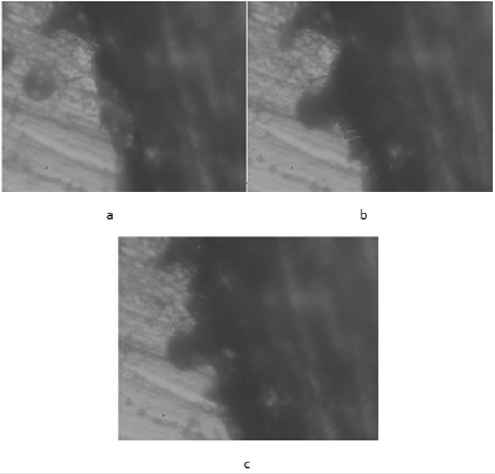 biomedres-openaccess-journal-bjstr