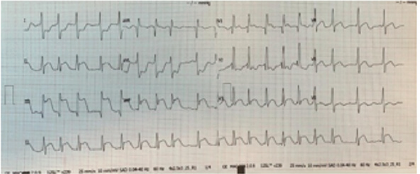 biomedres-openaccess-journal-bjstr