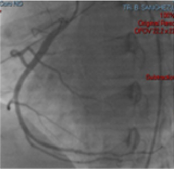 biomedres-openaccess-journal-bjstr