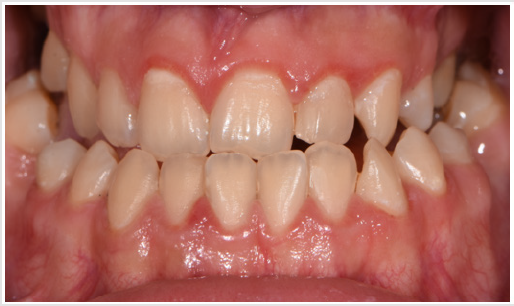 biomedres-openaccess-journal-bjstr