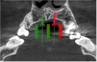 biomedres-openaccess-journal-bjstr