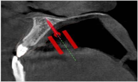biomedres-openaccess-journal-bjstr