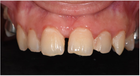 biomedres-openaccess-journal-bjstr