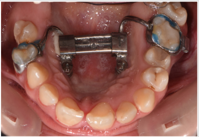 biomedres-openaccess-journal-bjstr