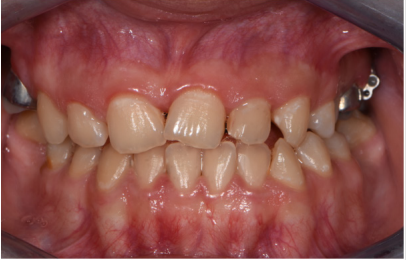 biomedres-openaccess-journal-bjstr