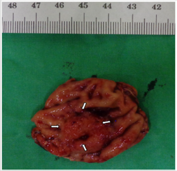 biomedres-openaccess-journal-bjstr