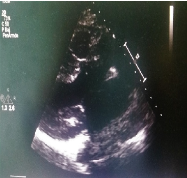 biomedres-openaccess-journal-bjstr