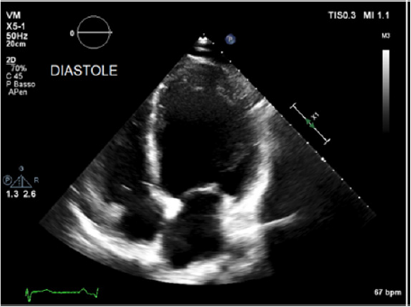 biomedres-openaccess-journal-bjstr