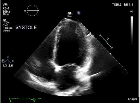 biomedres-openaccess-journal-bjstr