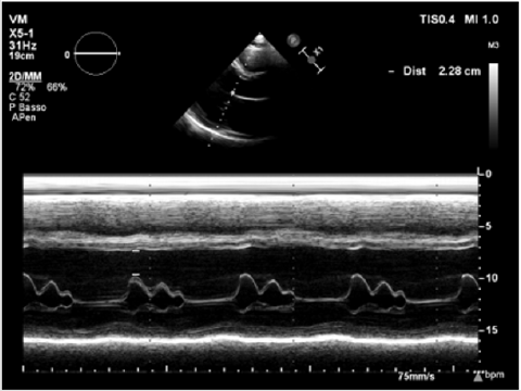 biomedres-openaccess-journal-bjstr