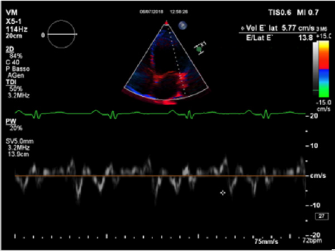 biomedres-openaccess-journal-bjstr
