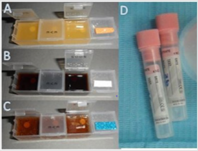 biomedres-openaccess-journal-bjstr