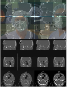 biomedres-openaccess-journal-bjstr
