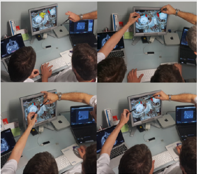 biomedres-openaccess-journal-bjstr