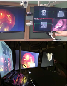 biomedres-openaccess-journal-bjstr