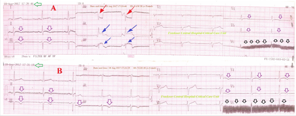 biomedres-openaccess-journal-bjstr