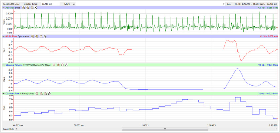 biomedres-openaccess-journal-bjstr