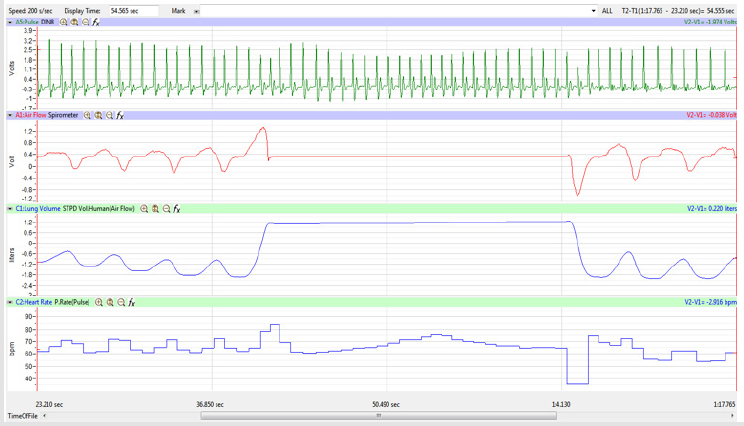 biomedres-openaccess-journal-bjstr