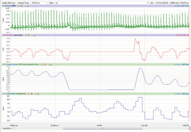 biomedres-openaccess-journal-bjstr