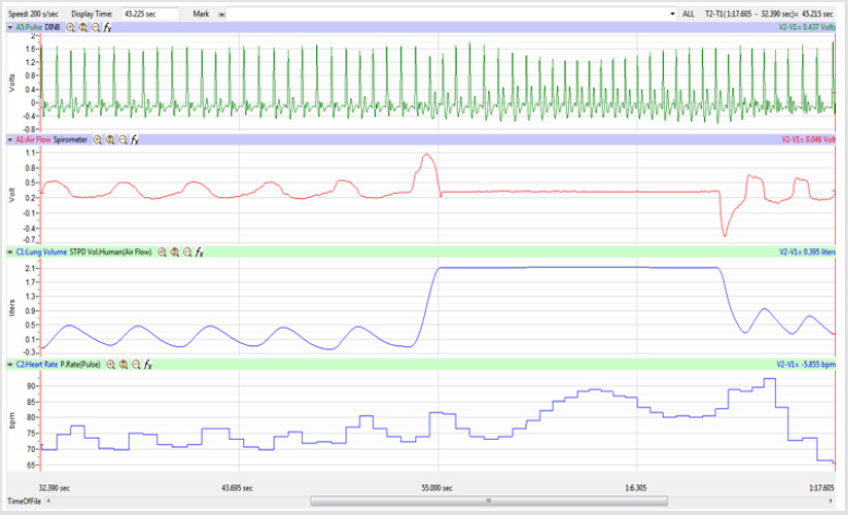 biomedres-openaccess-journal-bjstr