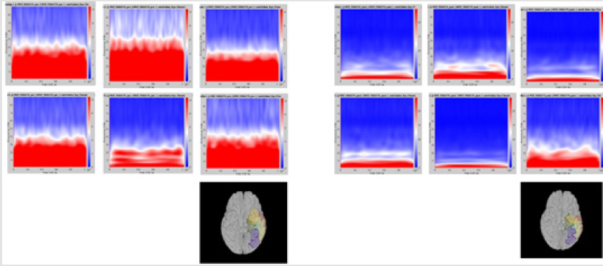 biomedres-openaccess-journal-bjstr