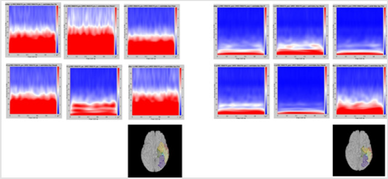 biomedres-openaccess-journal-bjstr