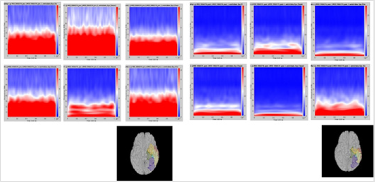biomedres-openaccess-journal-bjstr