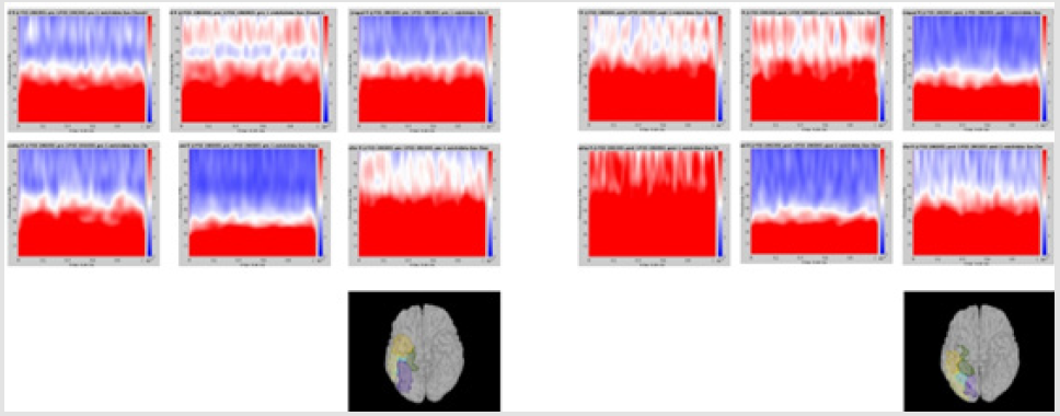 biomedres-openaccess-journal-bjstr